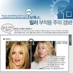 헐리웃 스타들의 보톡스와 <b>필러</b> 부작용~!!