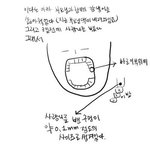 ‘사랑니와 <b>옥수수</b>’ 남의일이 아니였어…
