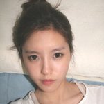 티아라 효민, 성형 하고도 또 <b>눈밑</b> 애교살까지?