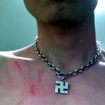 <사진有>남친한테맞는여자분도와주다 제가 맞았네요