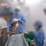 성형수술에 관하여