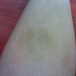 인천지하철 사고 - 그이후 두번의 대화