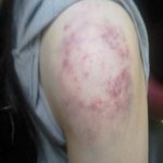 여자분들 진짜 밤길조심하세요..(사진有)