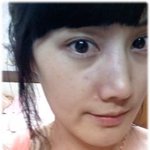 붉은점.. 화염성모반.. 그것도 얼굴에..