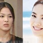 <b>치아</b>교정의 힘! 정말 이렇게 대단한거군요