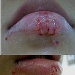 저희<b>집</b> 강아지에게 이렇게 물렸어요ㅠ.ㅠ(<b>사진</b>有)