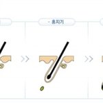일반샴푸 no, 한방샴푸 <b>yes</b>! 습관만 고쳐도 머리가 안 빠진다~ㅎ