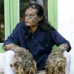 [사진有]나무인간 진짜 신기하네요 ㄷㄷ 구라아닙니다.