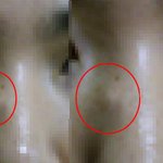 코위에 혹??ㅠㅠ [사진有]