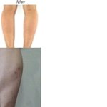 [사진有]나여자인데 종아리가ㅠ