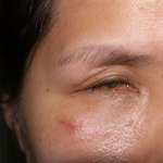 <b>캐디</b>로 일하다 실명이 되었는데 너무 억울 합니다, 제발 살려주세요