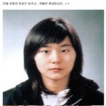 <b>유이</b> 성형전사진