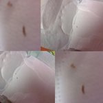 생리대에서 <b>벌레</b>가 나왔어요..