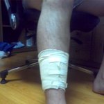 맨홀뚜껑에 빠져서 죽을뻔했어요 ㅠㅠ (사진有)