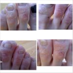 a*c mart 에서 새로산 신발 때문에 병원신세. (사진有)