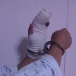 경찰 폭행,<b>직무</b>유기에 의하여 장애인이 되었습니다..