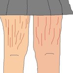 그림有) 덩을 참지못하는 내친구