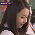 원더걸스 <b>소희</b> 피부, 얼굴에 다 퍼진 여드름ㅠ