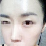 여드름정복기  제 인생이 달라졌어요