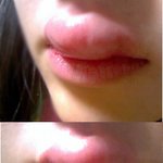 (사진有)살다보니 모기에게 <b>이런곳</b>도 물리네요ㅠㅠ