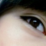 저는 쌍커<b>풀</b> 수술을 하지 않았어요!