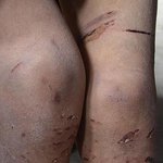 6살 어린애기를 상대로한 처참한 학대