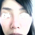 코성형..결과..물 <b>판단</b>!!