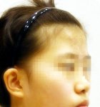 성형한 여자는 루저녀인가요??(인증샷<b>포함</b>)