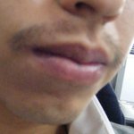 22살 <b>면도</b>하다가 난생 처음 119에 실려갔습니다 [사진有]