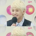 비스트에서 귀여움을 맡고있는 양요섭의 cracks of <b>my</b> broken