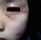 묻지마 폭행 당했어요. 때린사람은 영어교사.