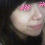 [사진 有] 성형수술없이 사각턱없앴어용 ~!