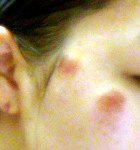 나를 업었다가 <b>코뼈</b>부러진 남자