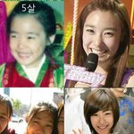 성형했다는 티파니