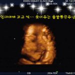 ★웃으면서 v하는 <b>아가</b> 초음파사진★