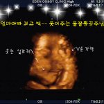 ♥웃으면서 v하는 아기 초음파 샤진 ♥