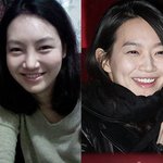 성형하고 신민아로 체인지업↗