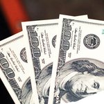 건강관리도 재테크다. (탈모, 잇몸<b>염증</b>, 시력)