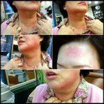 <b>lg</b>화장품 후 진율향 괄사마사지 마스크 사용후 이렇게됐어요 ㅠㅠ