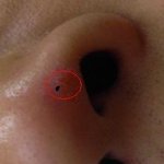 <b>코털</b>하나가 콧구멍 속이 아닌 밖에서 튀어나왔습니다.