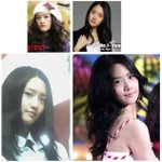 윤아 성형전 &amp; 윤아 <b>오다리</b> &amp;배꼽성형