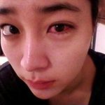 이민정 <b>눈병</b>!!!!!!!