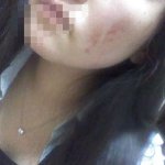 소개팅남에게 싸대기 맞은<b>사연</b> [사진有]