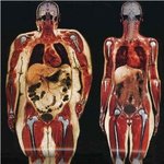 113kg/54kg <b>전신</b>스캐닝 비교사진!!