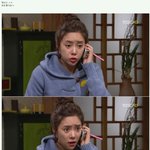 황정음 이마에 넣은 <b>실리콘</b>보이는 사진..