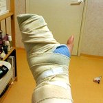 돌팔이 의사가 암<b>워머</b>해줬어요....사진有