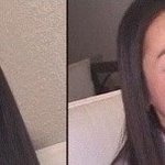 <b>치아</b>교정으로 얼굴이 활짝 핀 연예인