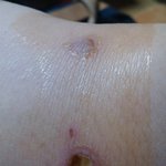 무서운 요새 병원ㅠㅠ(사진 有)