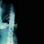 대박..충격적인 성형 <b>before</b> &amp; after (사진有)