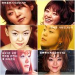 자우림의 김윤아 성형<b>전후</b>
